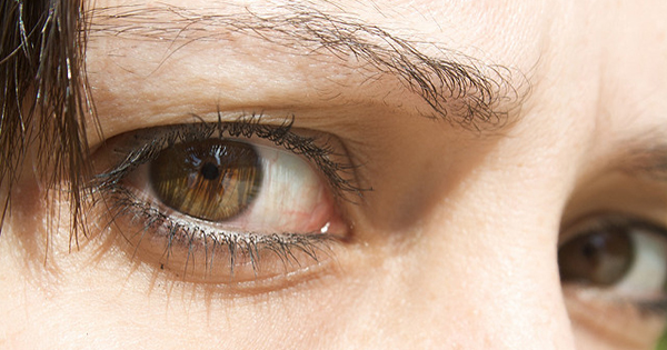 Čo prezradia vaše oči? Toto odhalil výskum
